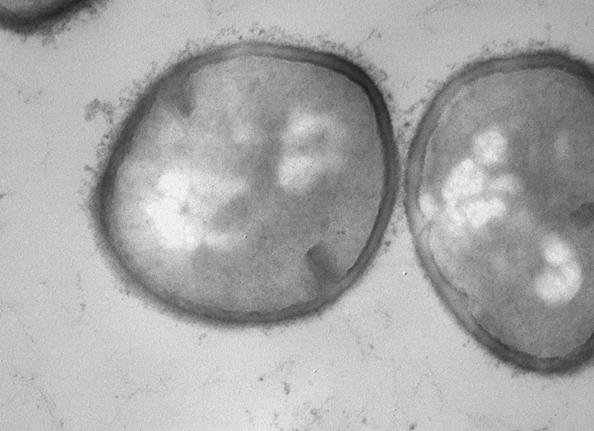アトピーの人の肌では黄色ブドウ球菌が「モンスター化」している?